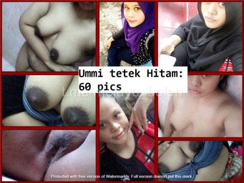 Ummi-tetek-hitam